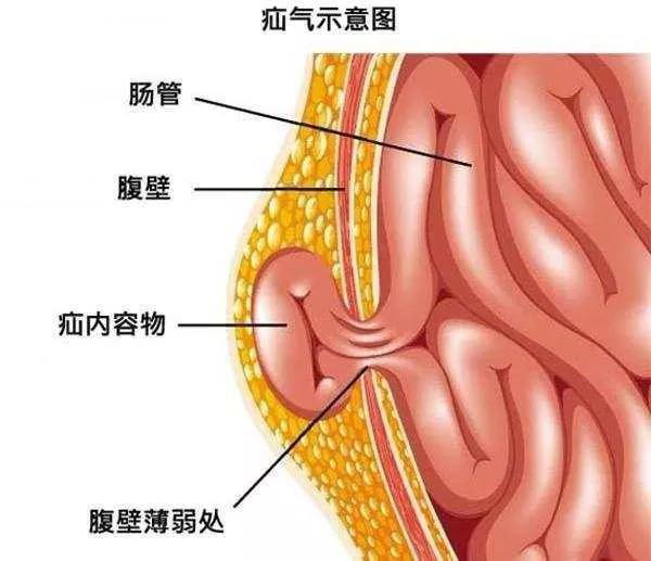 疝这个字怎么读图片