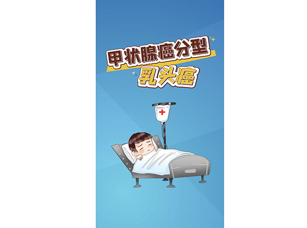 甲状腺癌分型乳头癌